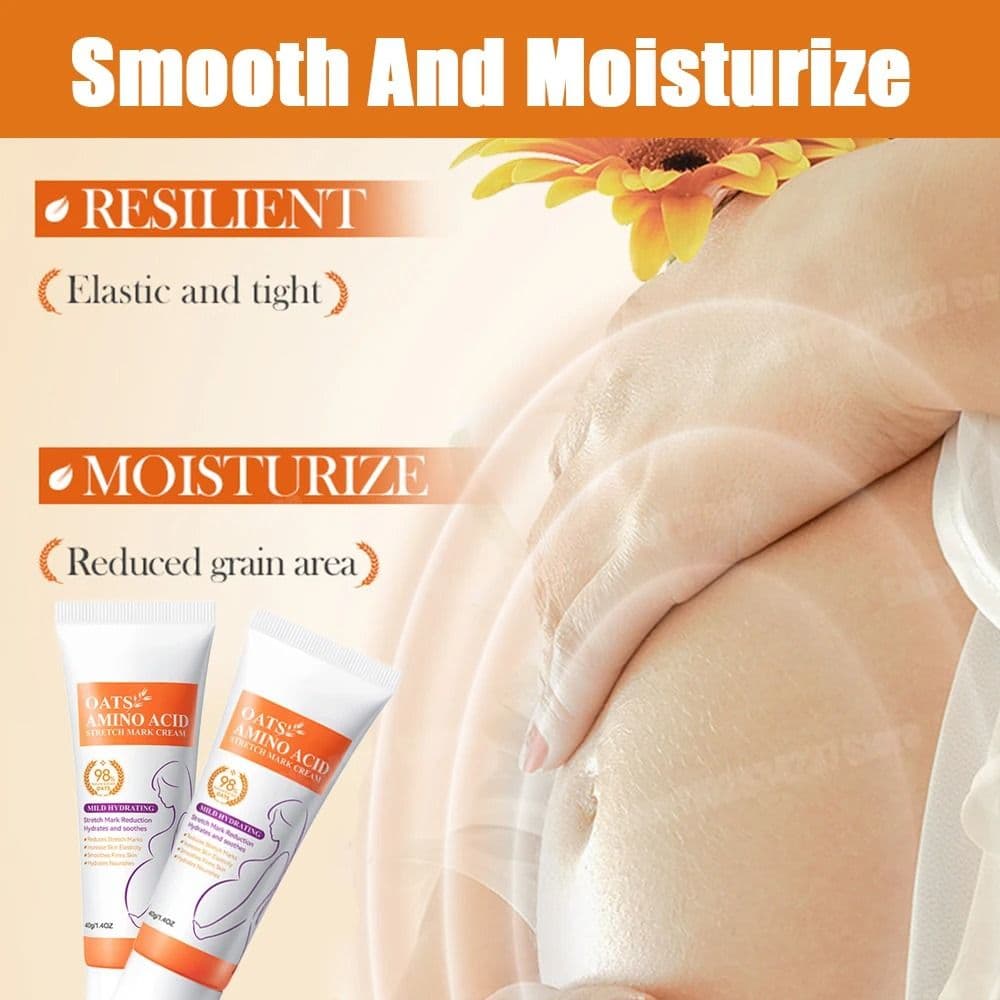 Stretch Marks Removal Cream Light Lines Postpartum Obesity Pregnancy Powerful Fast Absorption - thumbnail 3