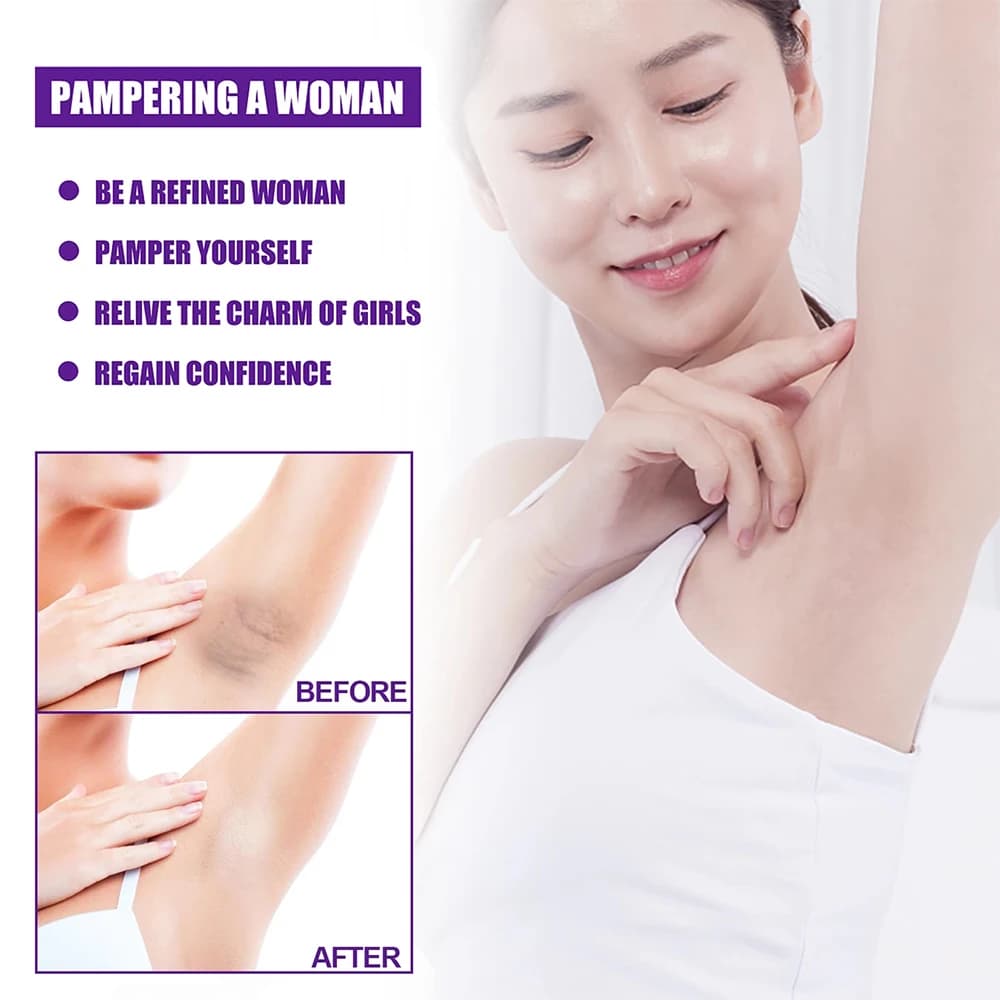 Whitening Cream Private Parts Underarm Bleaching Serum Whiten Butt Knee Brighten Inner Thigh Intimate Parts Dark Remove - thumbnail 5