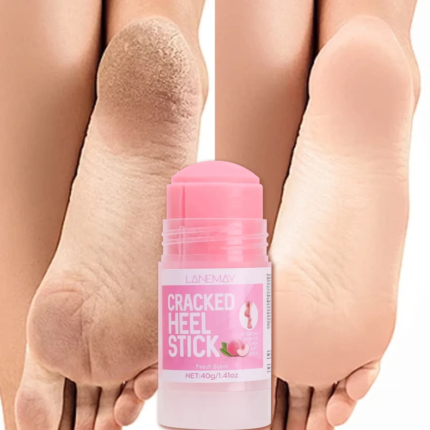  40g Ultra-Hydrating Foot Cream Softening Dry Cracked Feet Daily Foot Care Solution Feet Cream Stick Repairing Moisturizing Tool - thumbnail 5