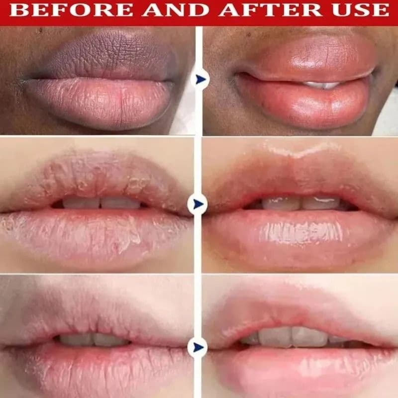 Remove Dark Lip Balm Lightening Melanin Mask Gloss Exfoliating Lip Pink Treatment Reduce Lip Lines Improve Dryness Moisturizing - thumbnail 6