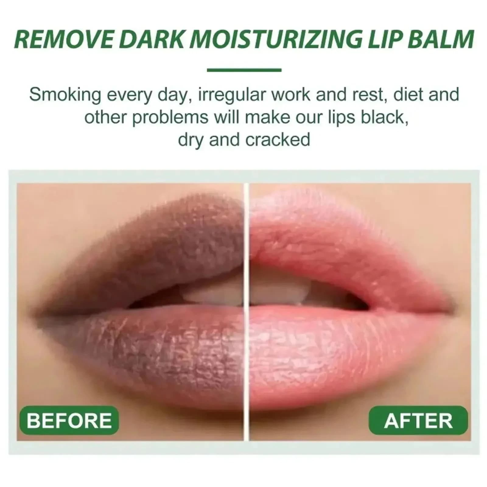 Remove Dark Lip Balm Fast Lightening Pink Lip Exfoliating Fade Lip Line Dead Skin Moisturizer Korean Care Products Beauty Health - thumbnail 2