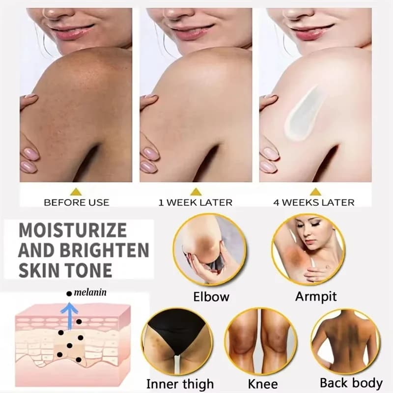 Whitening Cream Private Parts Underarm Bleaching Lotion Whiten Butt Knee Brighten Inner Thigh Intimate Parts Dark Remove - thumbnail 2
