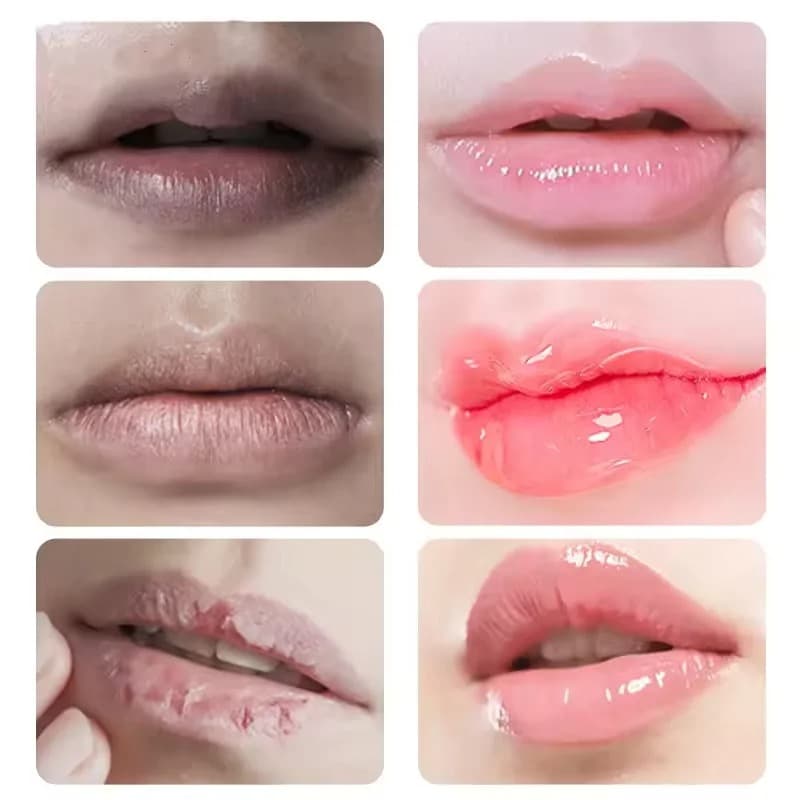 Remove Dark Lip Balm Fast Lightening Pink Lip Exfoliating Fade Lip Line Dead Skin Moisturizer Korean Care Products Beauty Health - thumbnail 4