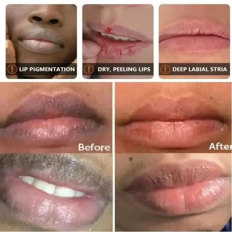Remove Dark Lip Balm Lightening Melanin Mask Gloss Exfoliating Lip Pink Treatment Reduce Lip Lines Improve Dryness Moisturizing - thumbnail 3