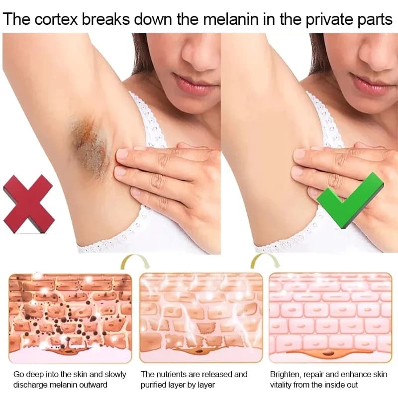 Whitening Cream Private Parts Underarm Bleaching Lotion Whiten Butt Knee Brighten Inner Thigh Intimate Parts Dark Remove - thumbnail 4