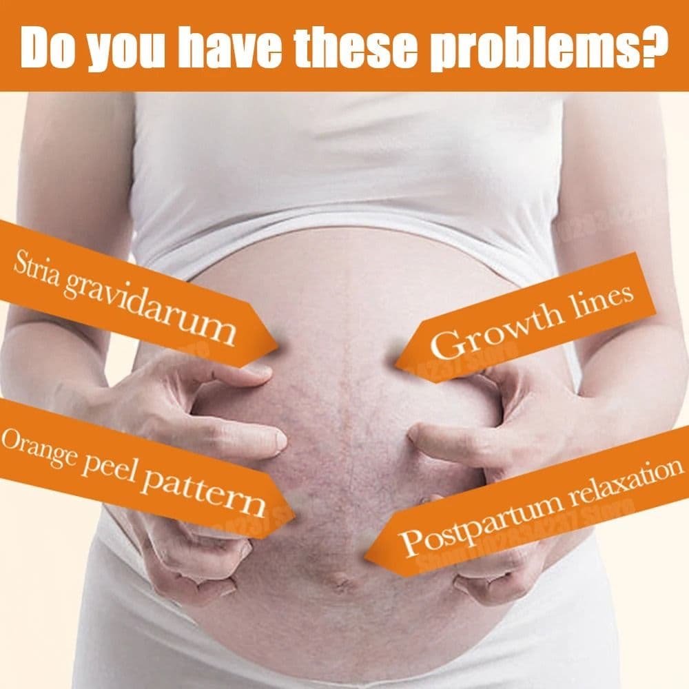 Stretch Marks Removal Cream Light Lines Postpartum Obesity Pregnancy Powerful Fast Absorption - thumbnail 2