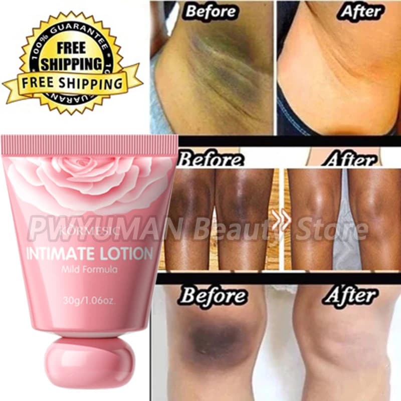Whitening Cream Private Parts Underarm Bleaching Lotion Whiten Butt Knee Brighten Inner Thigh Intimate Parts Dark Remove - thumbnail 3