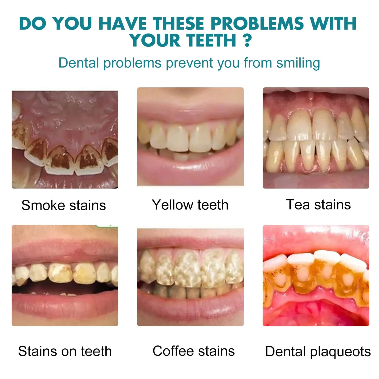 Teeth whitening paint for stain removal - thumbnail 2