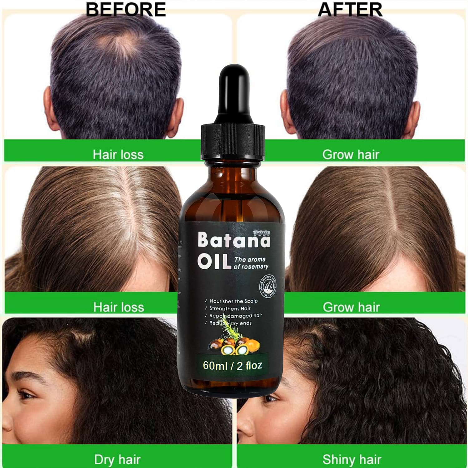 Only Supports Self Pickup With Waybill Amococo Batana Oil With Rosemary Cold Pressed Natural Hair Growth Oil, Nourishes Scalp, Repairs Damaged Hair, Reduces Split Ends, Boosts Hair Thickness & - thumbnail 10