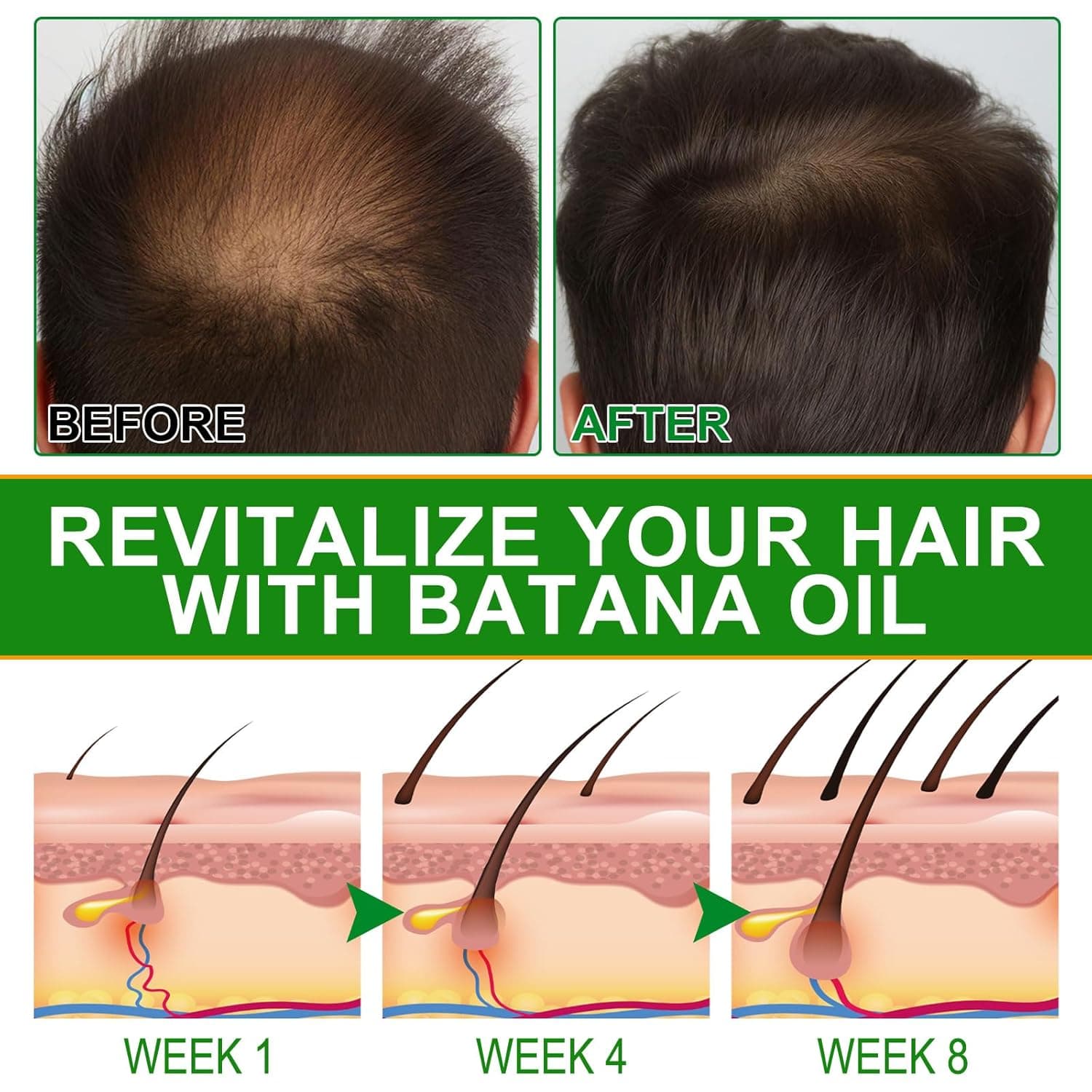 Only Supports Self Pickup With Waybill Amococo Batana Oil With Rosemary Cold Pressed Natural Hair Growth Oil, Nourishes Scalp, Repairs Damaged Hair, Reduces Split Ends, Boosts Hair Thickness & - thumbnail 10