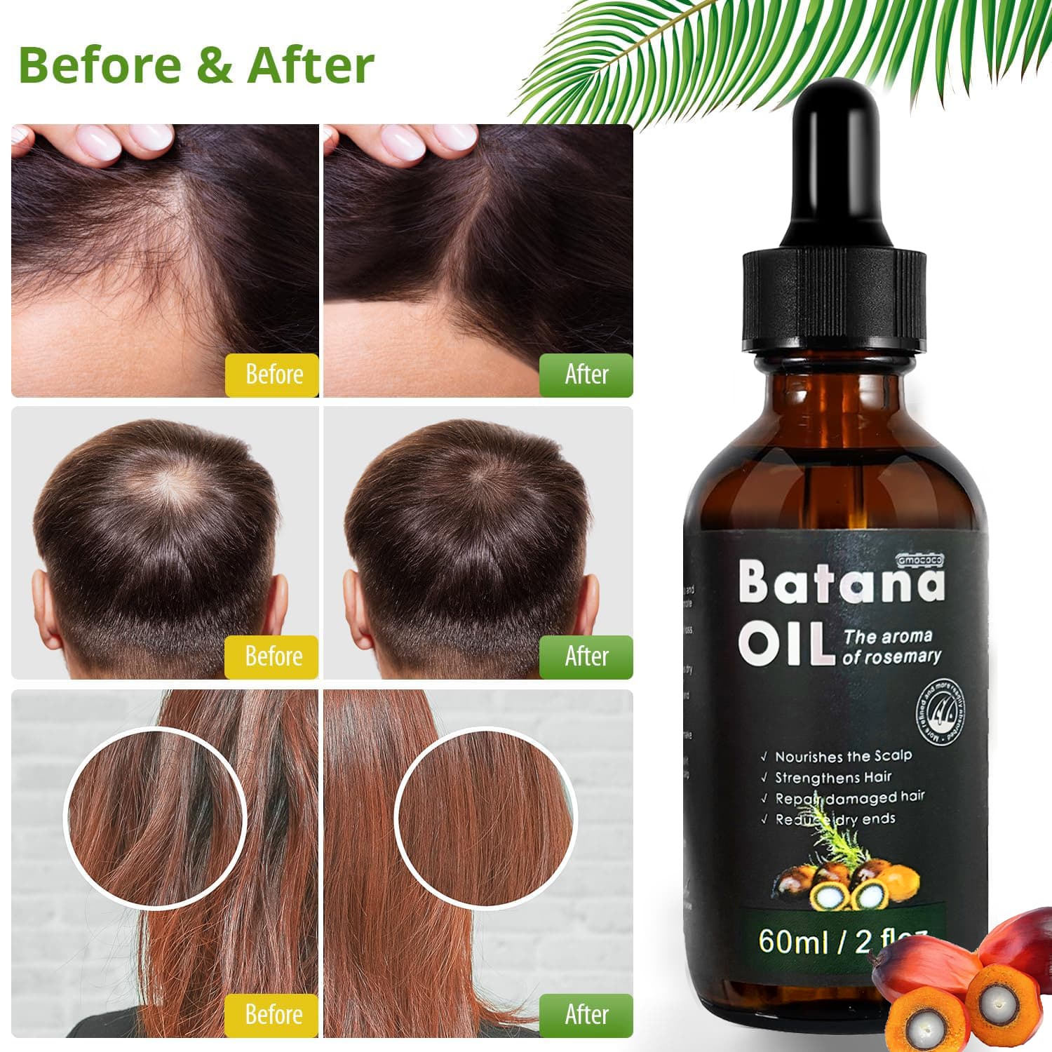Only Supports Self Pickup With Waybill Amococo Batana Oil With Rosemary Cold Pressed Natural Hair Growth Oil, Nourishes Scalp, Repairs Damaged Hair, Reduces Split Ends, Boosts Hair Thickness & - thumbnail 7