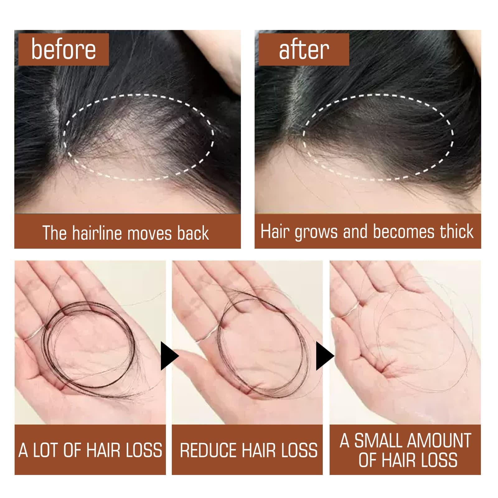 Batana Oil Hair Conditioner, Natural Batana Oil For Hair Growth For Healthier Thicker Hair, Stimulates Hair Follicles - thumbnail 3